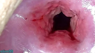Uncensored Japanese Cervix Stretching and Uterus Dilation with Bottomless pit